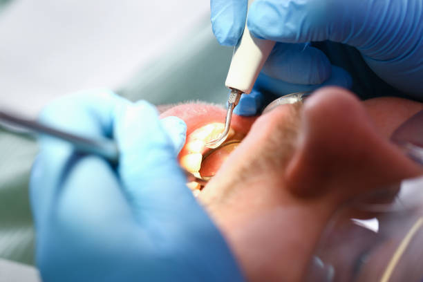 Best Emergency Gum Treatment in Omro, WI